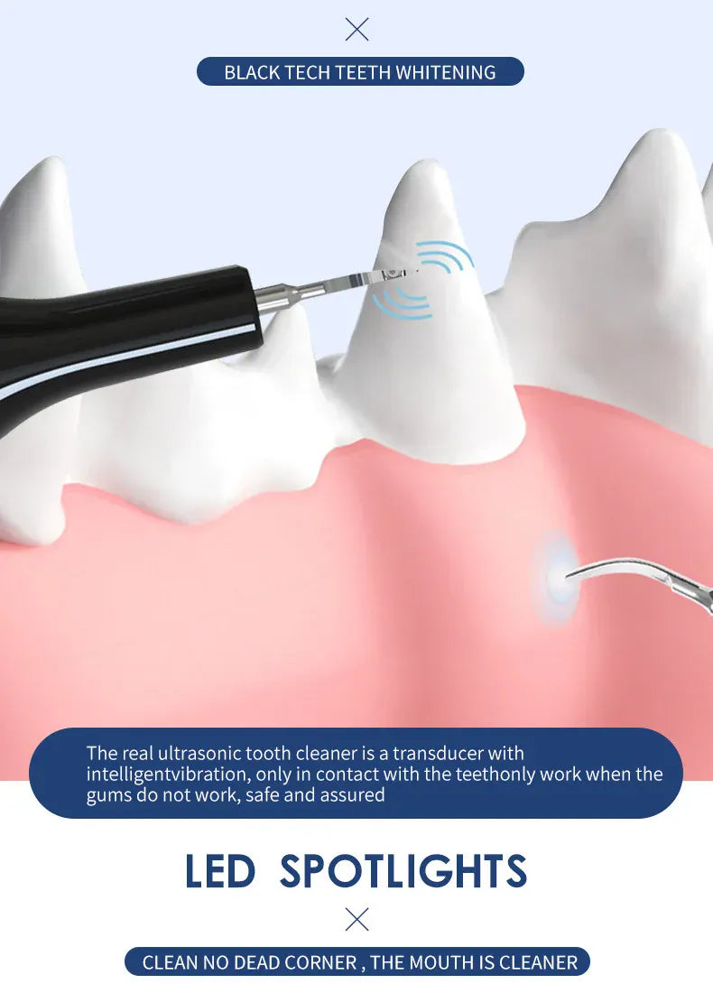 Ultrasonic Electric Dog Toothbrush | Professional Pet Plaque & Tartar Remover | Teeth Whitening & Dental Care