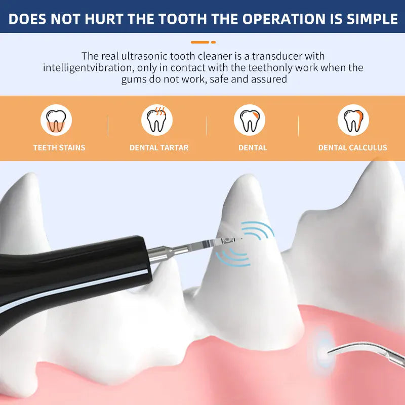 Ultrasonic Electric Dog Toothbrush | Professional Pet Plaque & Tartar Remover | Teeth Whitening & Dental Care